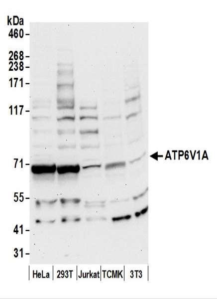 Anti-ATP6V1A