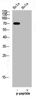 Anti-Phospho-FOXO1 (S329)