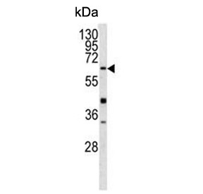 Anti-Glutathione hydrolase 5 proenzyme / GGT5 / GGTLA1