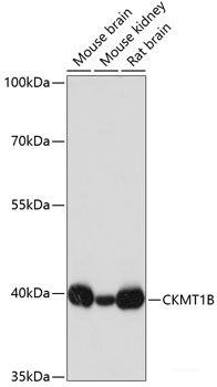 Anti-CKMT1A