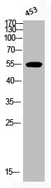 Anti-Phospho-AKT1 (T450)