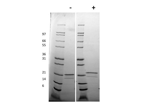 Interleukin-6 (AF)