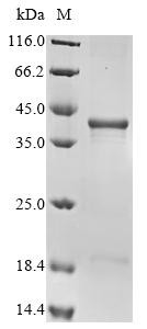 Survival motor neuron protein (SMN1), human, recombinant