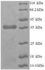 Protein-tyrosine phosphatase mitochondrial 1 (PTPMT1), human, recombinant