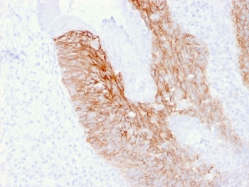 Anti-CD44v6, clone 2F10