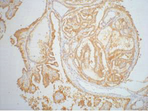 Anti-LGALS3 Monoclonal