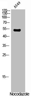 Anti-Phospho-VIM (S56)