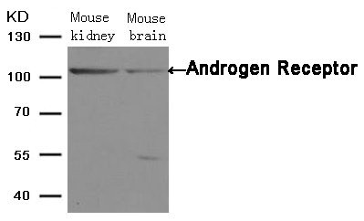 Anti-AR (Ab-650)