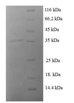 C-C motif chemokine 8 (CCL8), human, recombinant