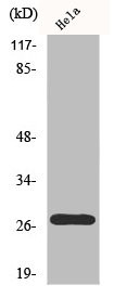 Anti-Phospho-CDKN1B (T187)