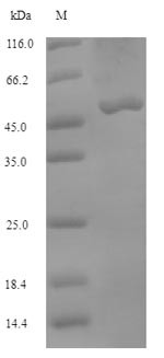 Bifunctional methylenetetrahydrofolate dehydrogenase/cyclohydrolase, mitochondrial (MTHFD2), bovine,