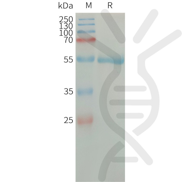 Human CFD Protein, hFc Tag