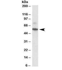 Anti-Peripherin