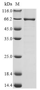 Alpha-ketoglutarate-dependent dioxygenase FTO (FTO), human, recombinant