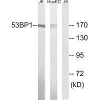 Anti-TP53BP1 (Ab-29)