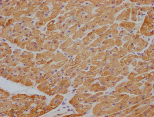 Anti-ACTB/POTEKP/ACTG1 Monoclonal