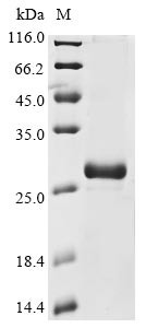 Guanylate cyclase soluble subunit alpha-2 (GUCY1A2), partial, human, recombinant