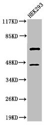 Anti-Cleaved-CASP8 (D384)