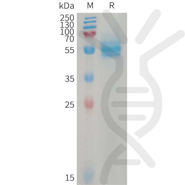 Human CD14(20-352) Protein, His Tag