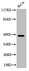 Anti-Cleaved-KLKB1 (R390)