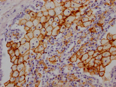 Anti-ACE Recombinant Monoclonal, clone 2H8