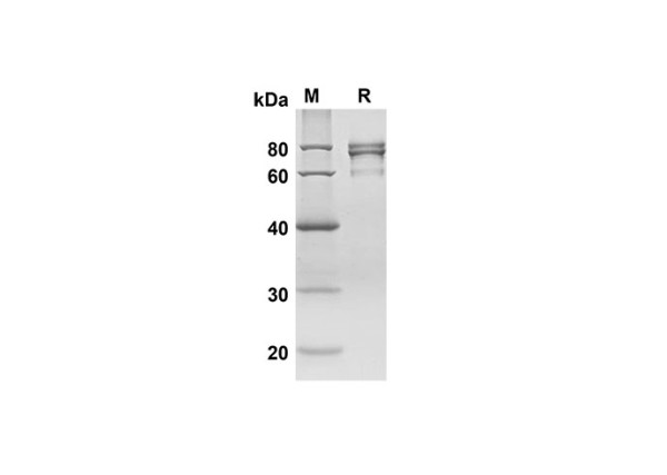 CA9 Protein ( Fc Tag) (recombinant human)