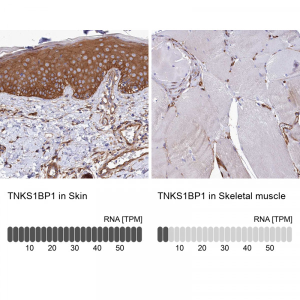 Anti-TNKS1BP1