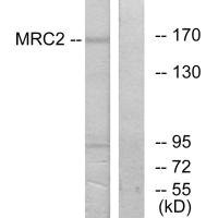 Anti-MRC2