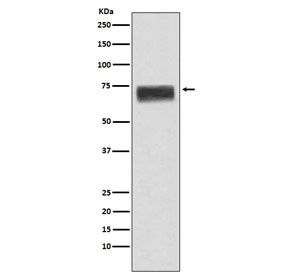 Anti-Hemopexin / HPX, clone ADAD-8