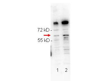 Anti-phospho-NFkappaB p65 (Ser276) (NFkappaB, Nuclear Factor kappa B, RelA)