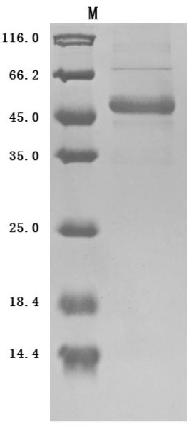 Tumor necrosis factor ligand superfamily member 9 (TNFSF9), partial (Active), human, recombinant