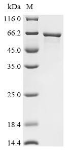 E3 ubiquitin-protein ligase makorin-1 (MKRN1), human, recombinant