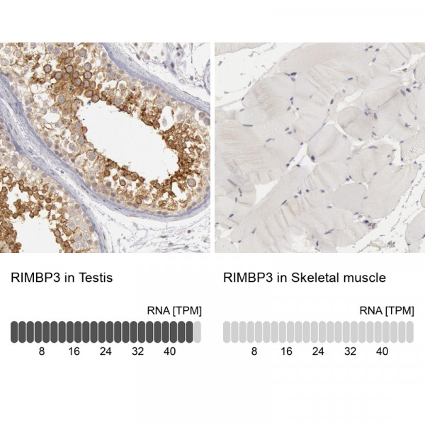 Anti-RIMBP3