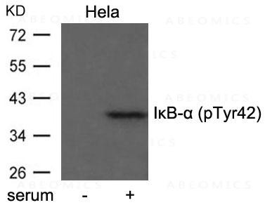 Anti-phospho-IkB- Alpha (Tyr42) Antibody
