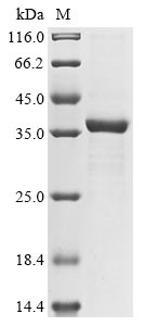 Palmitoyl-protein thioesterase 1 (PPT1), bovine, recombinant
