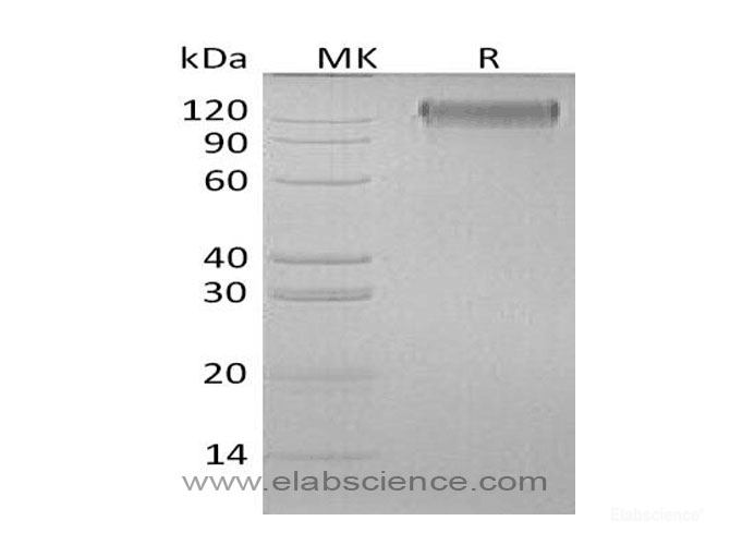 Oncostatin M Specific Receptor Subunit Ss Osmrb Il 31rb Protein C 6his Recombinant Human Elabscience Biomol Com