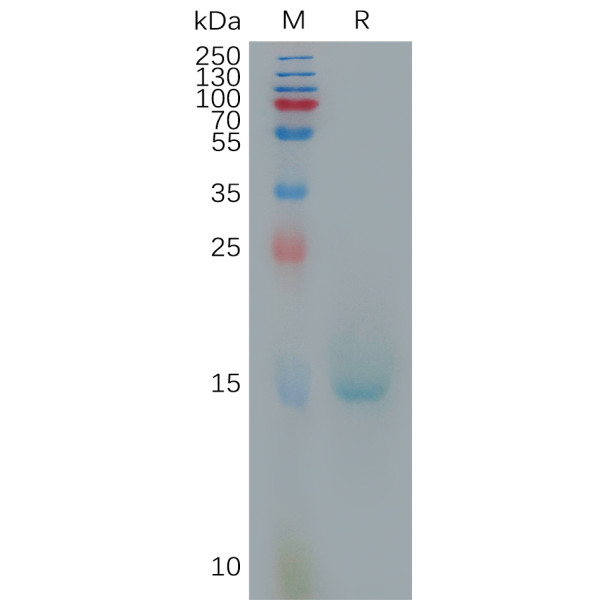 Human IL10 Protein, His Tag