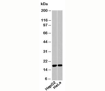 Anti-Acid Phosphatase (Isoform 2 specific)