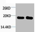 Anti-Histone H1 (PACO00104)