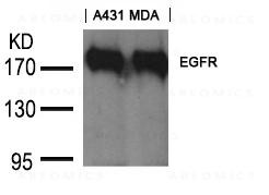 Anti-Goat Polyclonal Antibody to EGFR (Ab-1197)