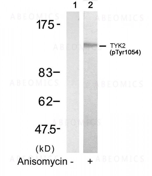 Anti-phospho-TYK2 (Tyr1054)