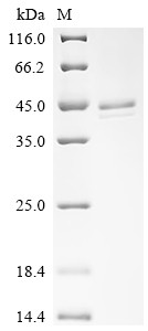 Lactotransferrin (LTF), partial, human, recombinant