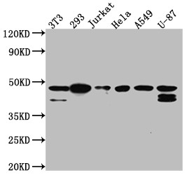 Anti-CSNK2A1 Recombinant Monoclonal, clone 2B6