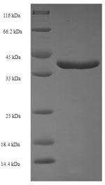 Ras-related protein Rab-11A (RAB11A), human, recombinant