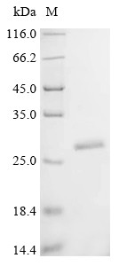 Lysine-specific demethylase 6B (KDM6B), partial, human, recombinant