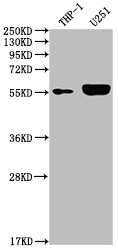 Anti-IRAK4 Recombinant Monoclonal, clone 10H4