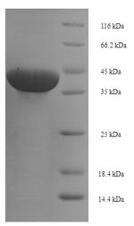 Butyrophilin subfamily 3 member A1 (BTN3A1), partial, human, recombinant