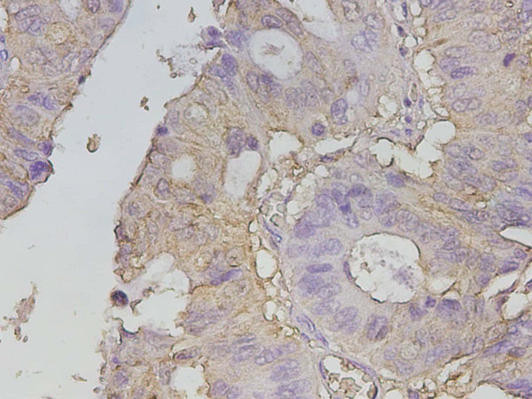 Anti-Galectin-3