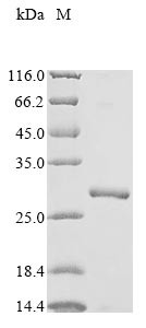 Voltage-dependent anion-selective channel protein 1 (VDAC1), partial, human, recombinant