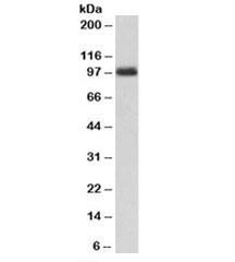 Anti-CSF3R